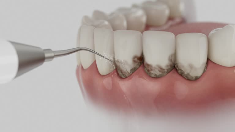 Reliable Dental contractor in Archer City, TX by Smile Center Dentistry
